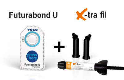 Futurabond U und x-tra fil sind ideal für eine schnelle und günstige Basisversor